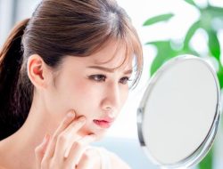 4 Mitos soal Kulit Sensitif, Berjerawat Berarti Sensitif?