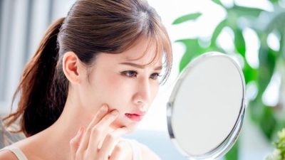 4 Mitos soal Kulit Sensitif, Berjerawat Berarti Sensitif?