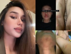 Viral Mahasiswi UPH Tangerang Diduga Dianiaya Mantan Pacar