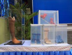 RSUD Kota Tangerang Hadirkan Layanan Trauma Center dan Ortotik Prostetik