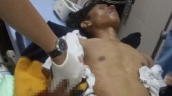 Saling Tantang saat Live Medsos, Pemuda di Balaraja Tangerang Dikeroyok Sampai Tangannya Putus