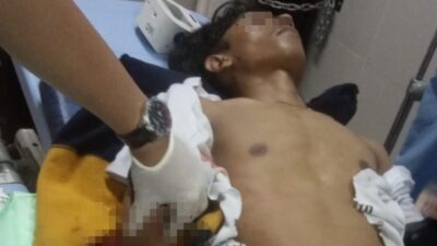 Saling Tantang saat Live Medsos, Pemuda di Balaraja Tangerang Dikeroyok Sampai Tangannya Putus