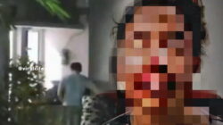 Viral, Suami di Serpong Tangsel Tega Aniaya Istri yang Hamil 4 Bulan hingga Luka Parah 