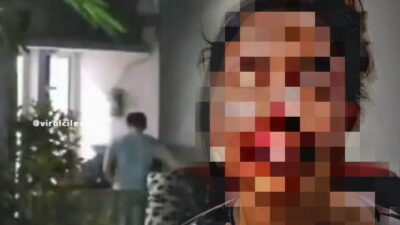 Viral, Suami di Serpong Tangsel Tega Aniaya Istri yang Hamil 4 Bulan hingga Luka Parah 