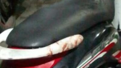 wanita ini kejar maling yang bobol tokonya hingga terluka karena di gerendeng tangerang
