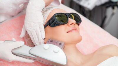 Manfaat V Beam Laser untuk Kulit