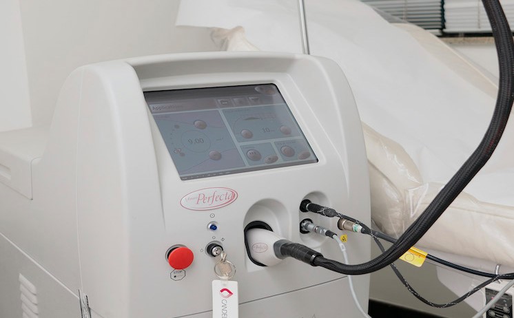 V Beam Laser
