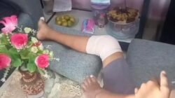 bocah kejar klakson telolet kakinya retak terlindas bus di jalan raya kotabumi